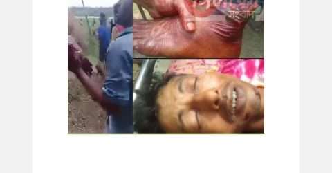 ব্রাহ্মণবাড়িয়ার নবীনগরে প্রতিপক্ষের পায়ের গোড়ালি কেটে মিছিল