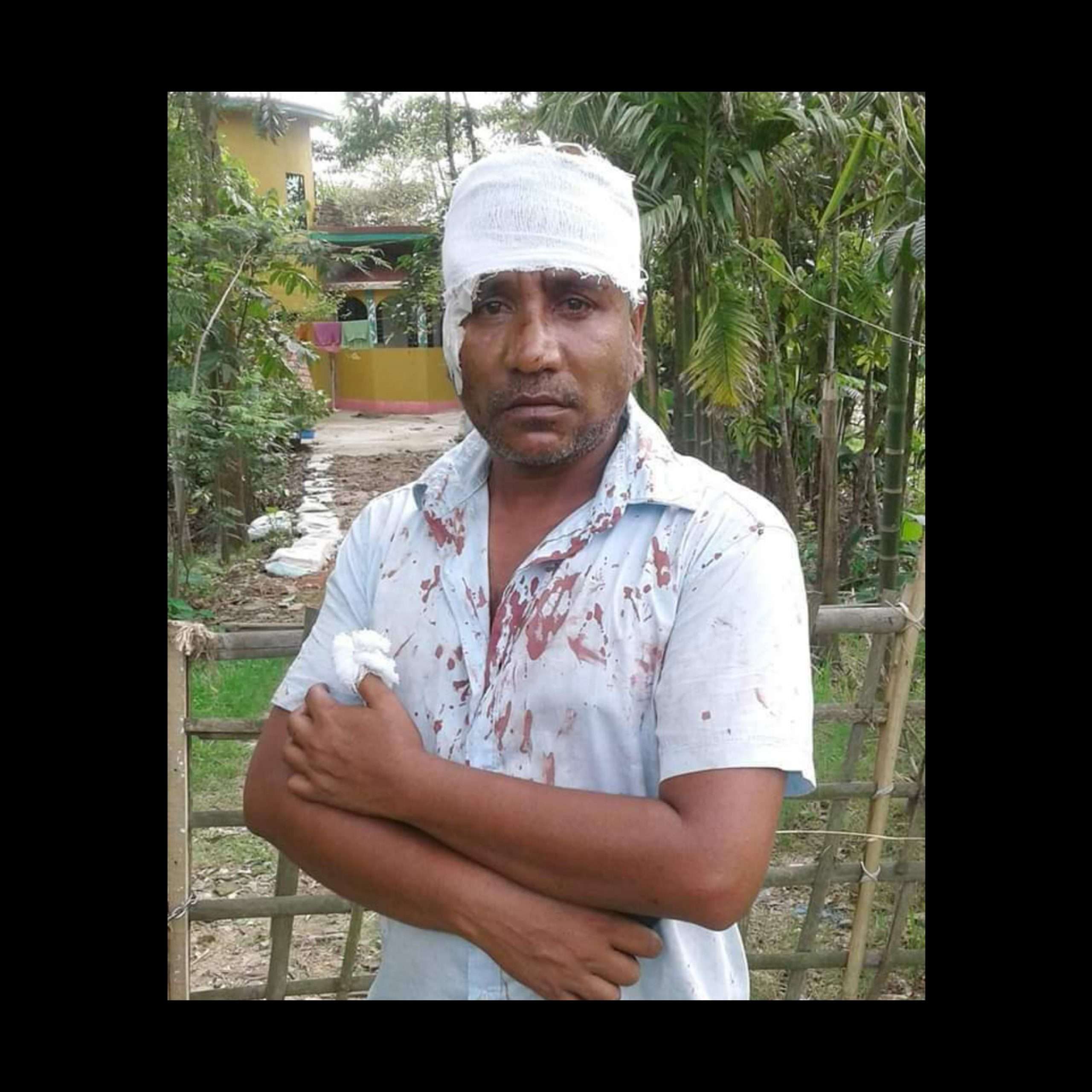 বিশ্বনাথে ডাকাতি মামলার আসামী কর্তৃক সাংবাদিকের উপর হামলা