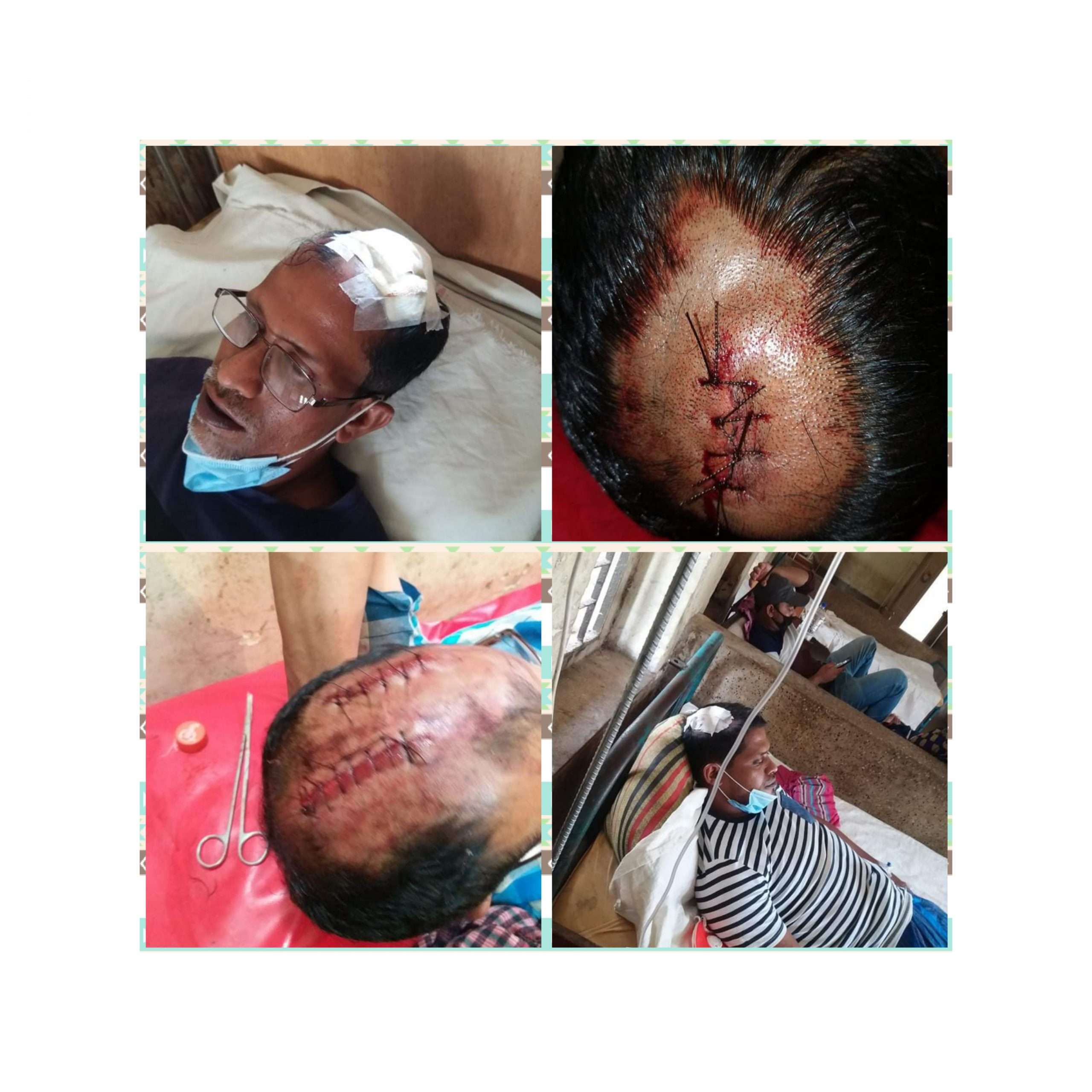 বুড়িচংয়ে চলাচলের রাস্তা নিয়ে প্রতিপক্ষের হামলায় ২জন আহত