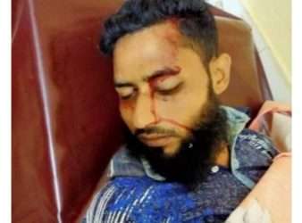 জৈন্তাপুরে সড়ক দূর্ঘটনায় নিহত ১ আহত ৩