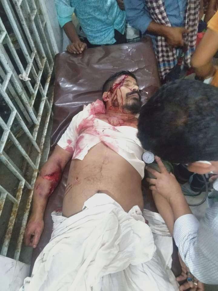 কোম্পানীগঞ্জে সড়ক দূর্ঘটনায় জেলা শ্রমিক নেতা মাসুক শাহ ঘোরতর আহত