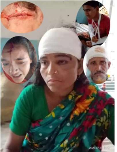 বড় ভাইয়ের সম্পত্তি জবর-দখল নিতে একই পরিবারের ৪ জনকে কুপিয়ে জখম