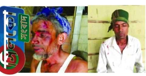 কোম্পানীগঞ্জের হায়দরি বাজারে প্রতিপক্ষের হামলায় দুই জন আহত