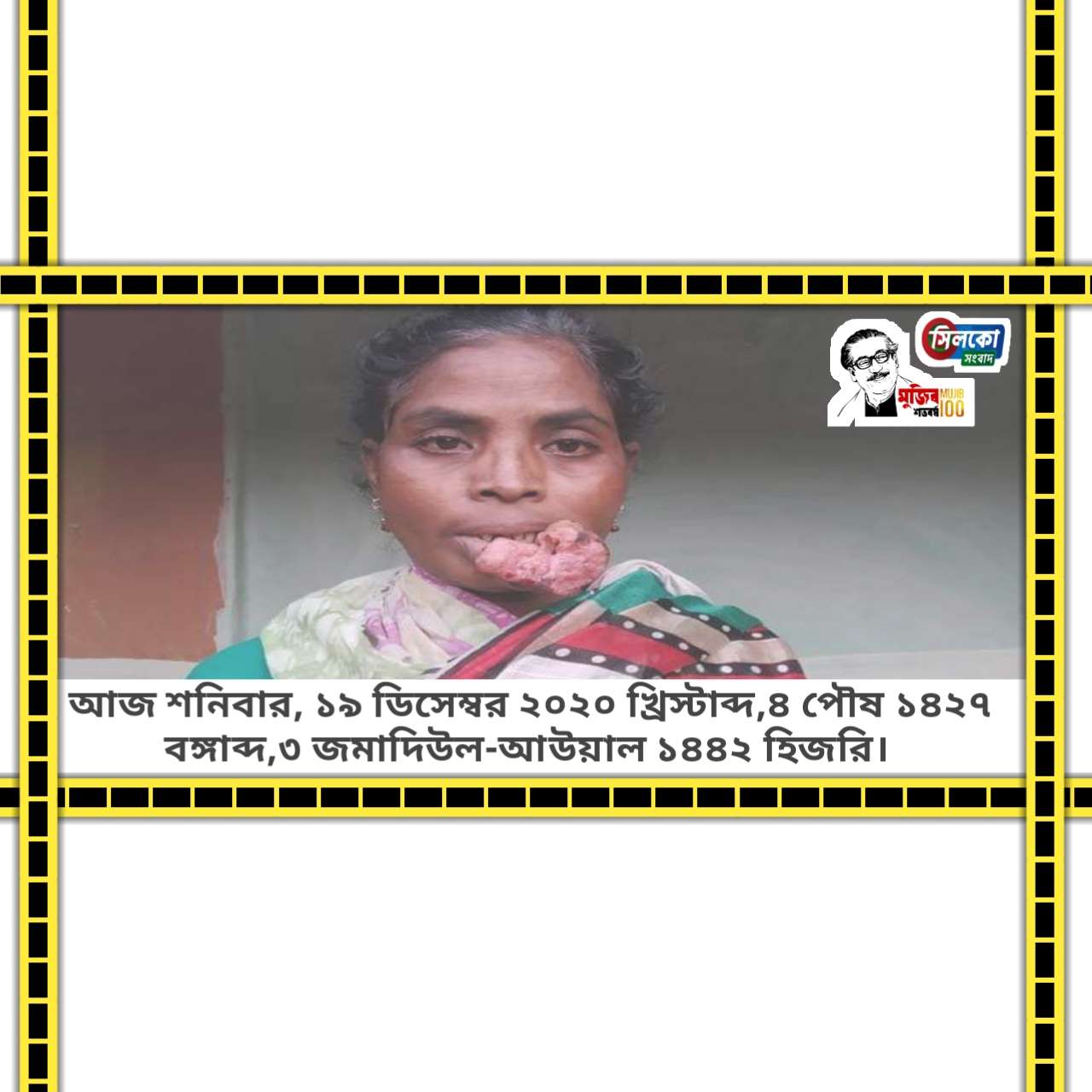 চুন মিশ্রিত মলাসাদা খেয়ে মৃত্যুর পথে দরিদ্র এক চা শ্রমিক