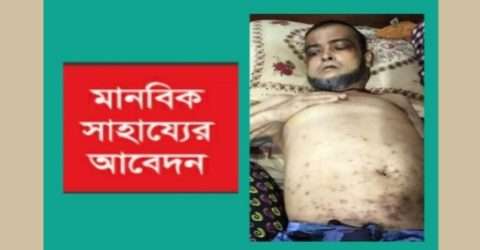 আপনার সাহায্যে বাঁচতে পারে ছাতকের জামাল