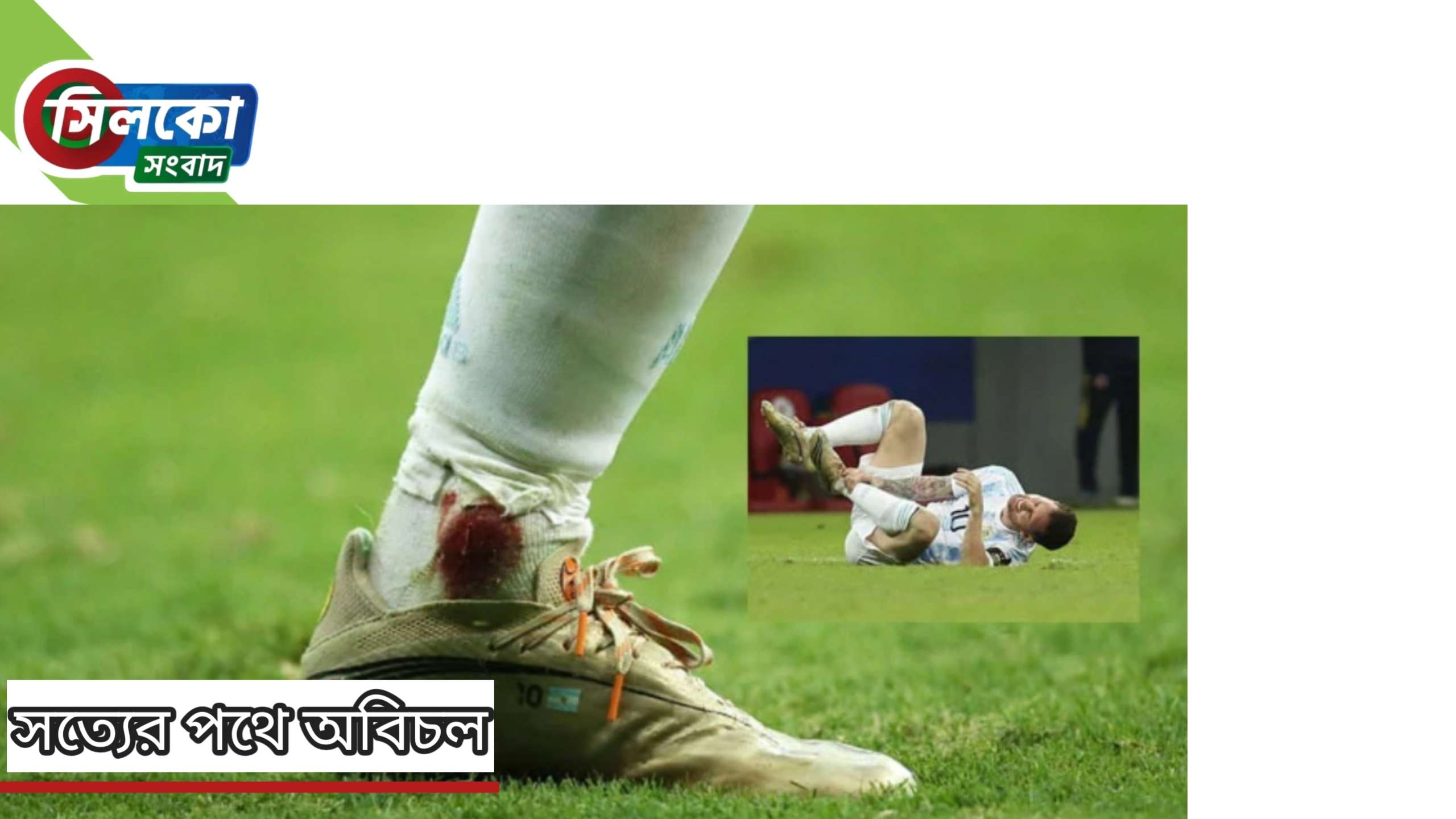 পা থেকে রক্ত ঝরছে মেসির,ফাইনাল ম্যাচ খেলতে পারবে?