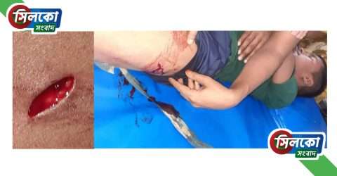 ছাতকে কিশোরকে কুপিয়ে জখম