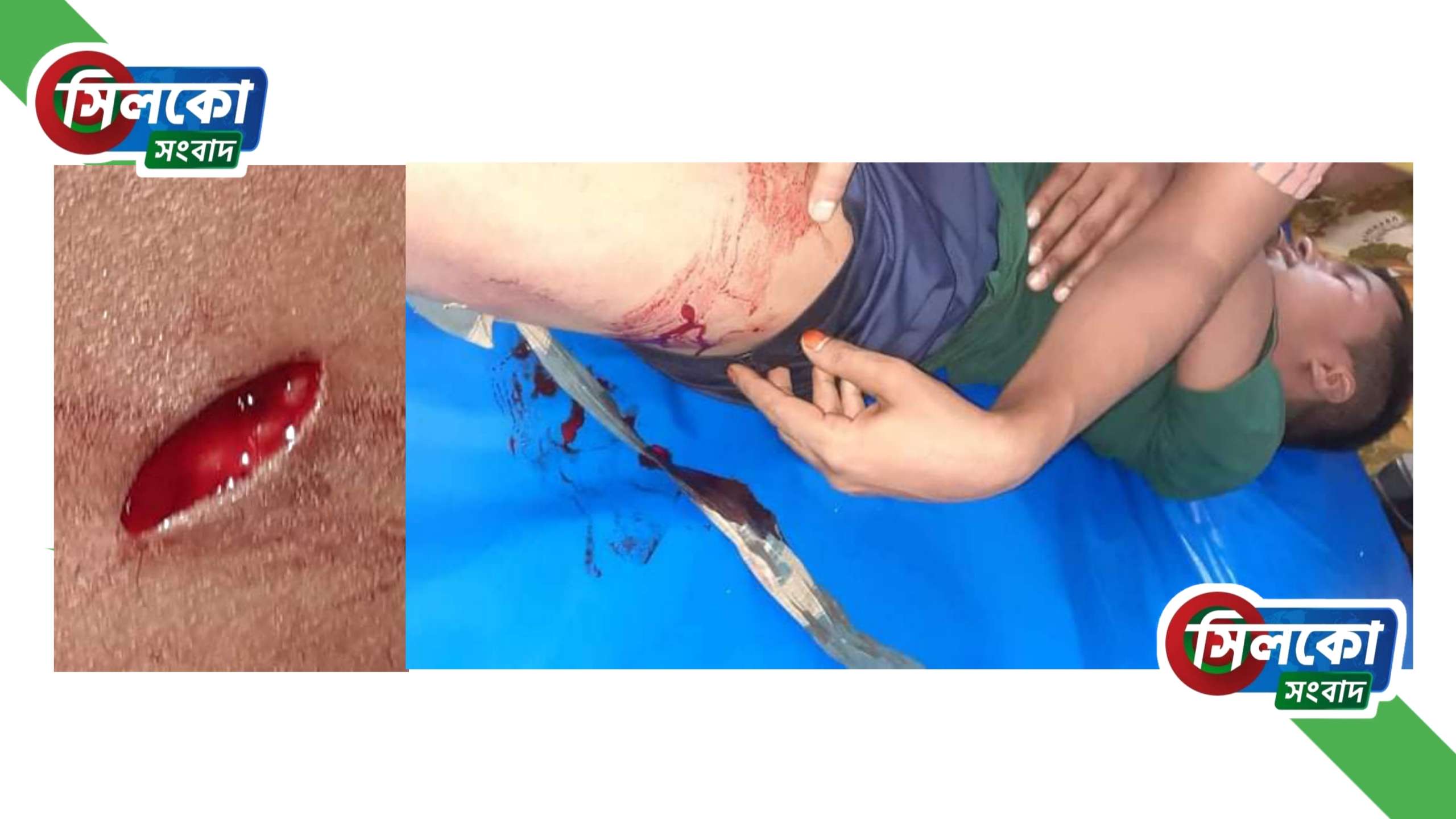 ছাতকে কিশোরকে কুপিয়ে জখম