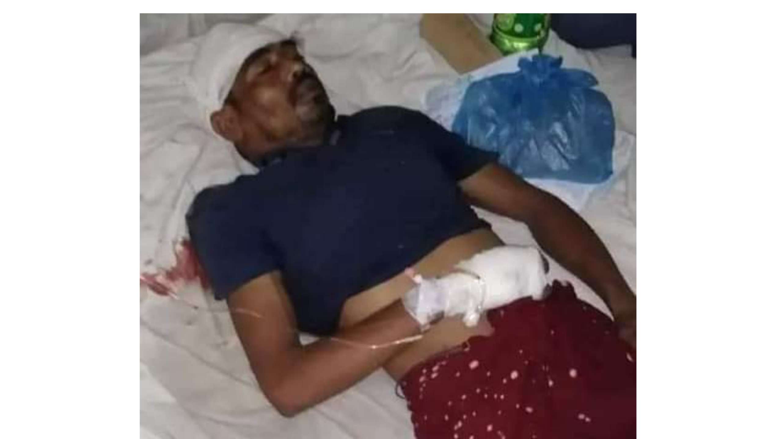 ছাতকে বিদ্যুৎস্পৃষ্টে আহত বিদ্যুৎ শ্রমিক শামীমের মৃত্যু