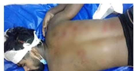 প্রেমিকা নিয়ে দুই বন্ধুর মারামারি