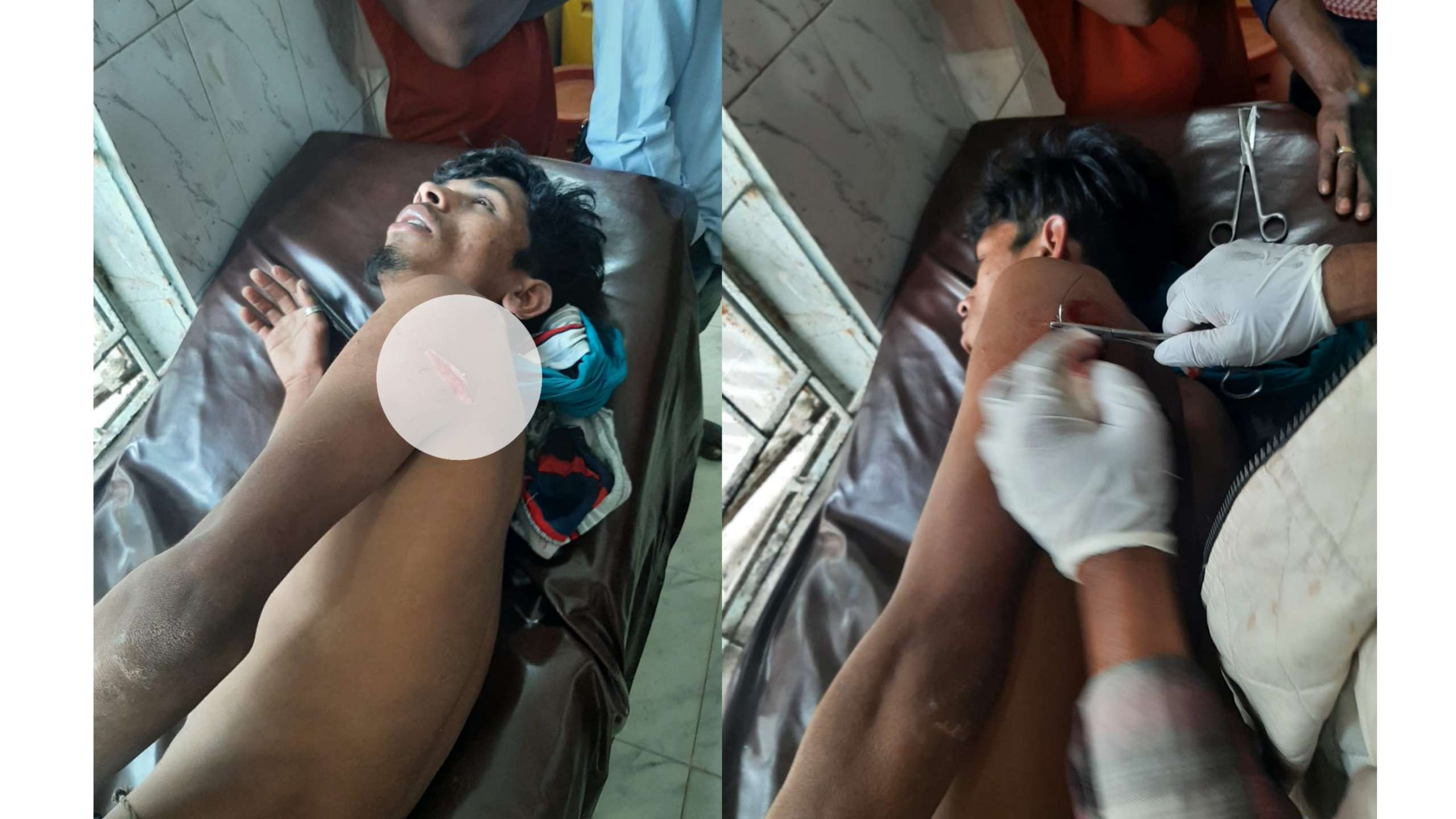 টুকের বাজারে সবজি বিক্রেতাকে প্রকাশ্য ছুরিকাঘাত, নিরাপত্তাহীন ব্যবসায়ীরা