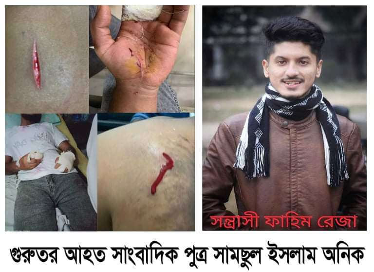 গাজীপুরে দূর্বৃত্তকতৃক  সাংবাদিক পুত্রকে কুপিয়ে জখম