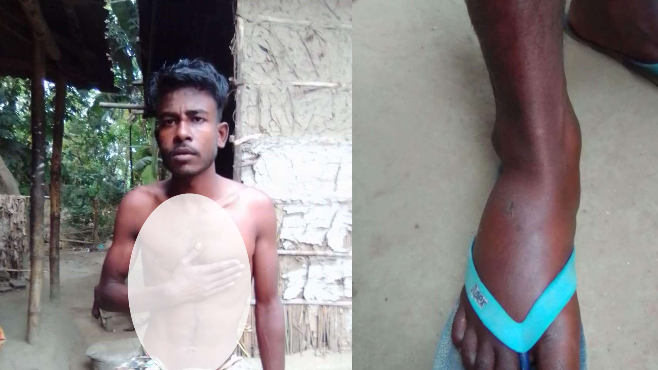 দোয়ারায় খেলাধুলাকে কেন্দ্র করে সন্ত্রাসী কায়দায় মারপিটে গুরুতর আহত এক