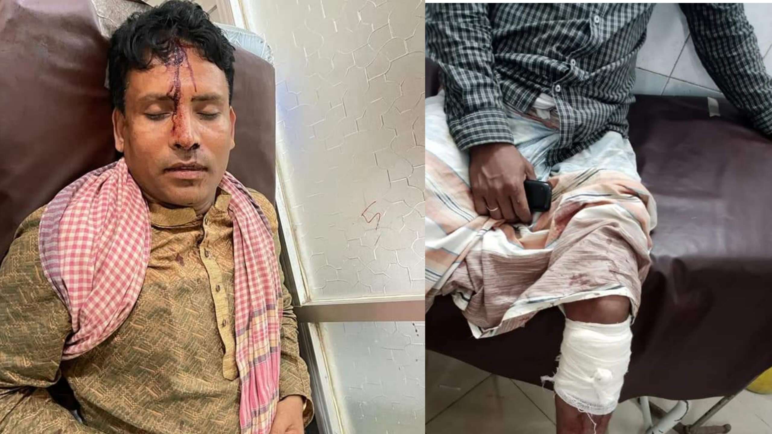 কোম্পানীগঞ্জে পাল্টা-পাল্টি সংঘর্ষে চেয়ারম্যান সহ ৩ জন আহত