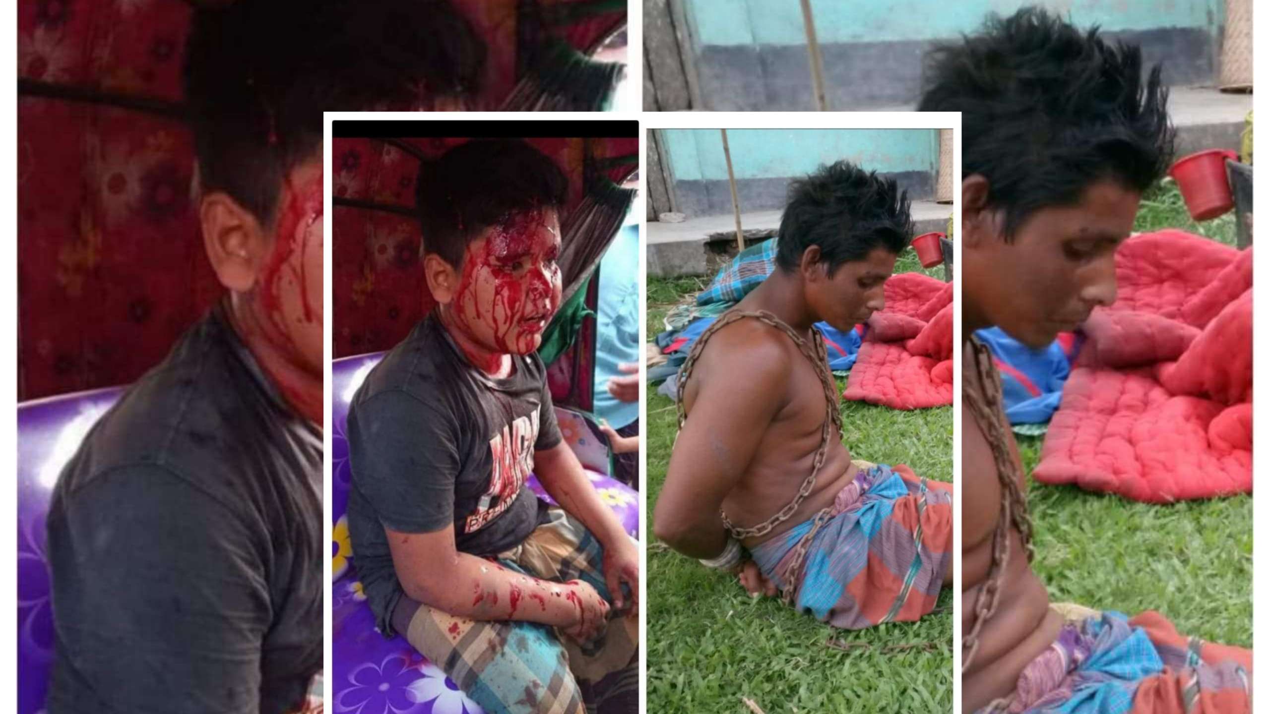 দোয়ারাবাজারে পাগলের মারধরে গুরুতর আহত শিশু শ্রমিক