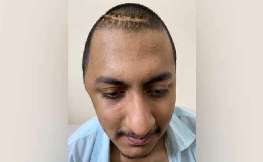 ছাত্রলীগের দুপক্ষের সংঘর্ষে আহত আকিব বাড়িতে ফিরলেন