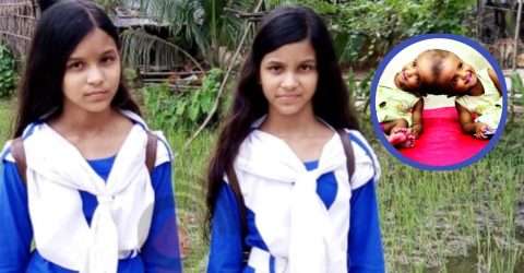 জোড়া মাথাওয়ালা “মনি-মুক্তা” এখন সপ্তম শ্রেণীর শিক্ষার্থী